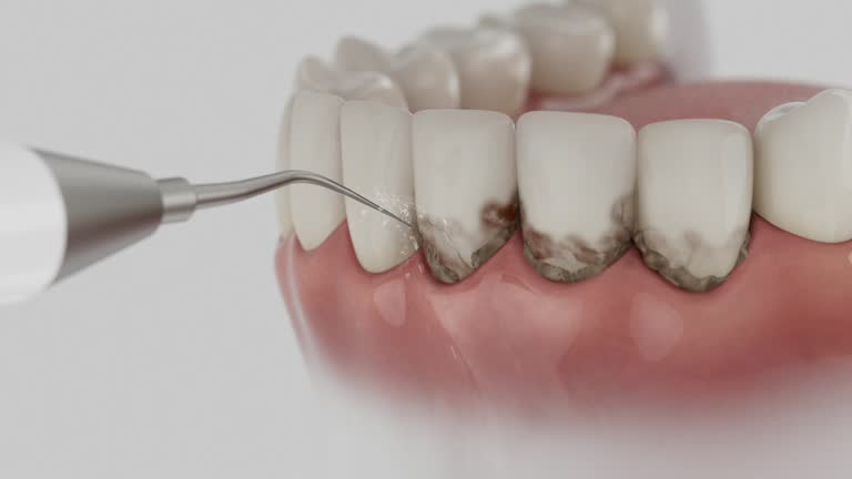 Reliable Dental contractor in Gahanna, OH by Dentist Open Now